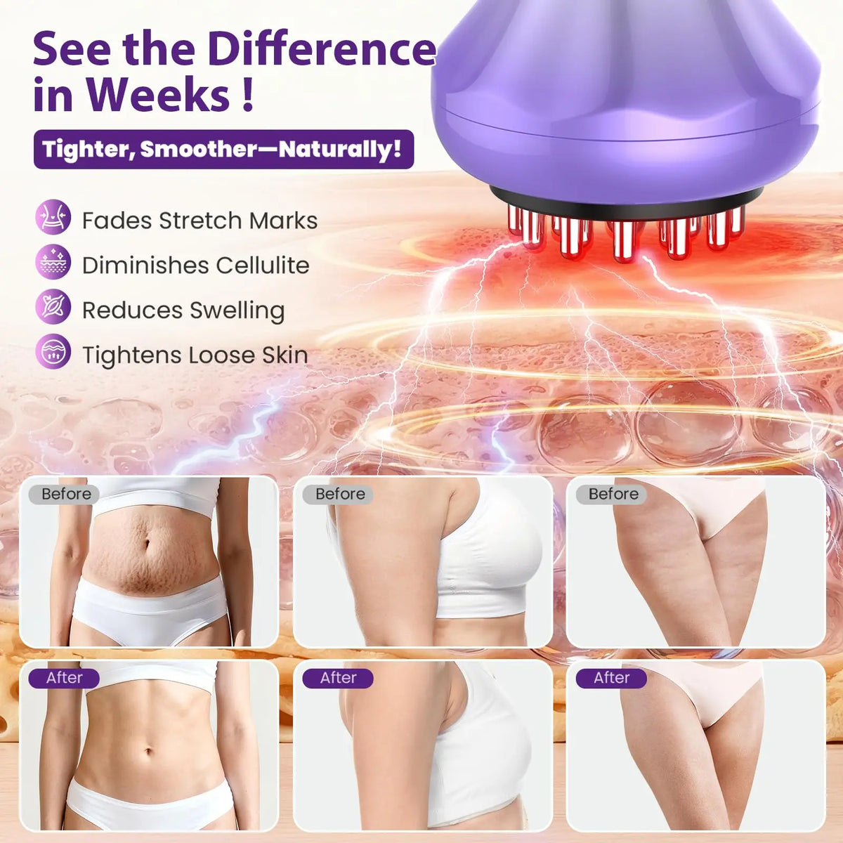 4-in-1 Electric Body Sculpting & Lymphatic Drainage Massager Body Sculpting Massager Qst