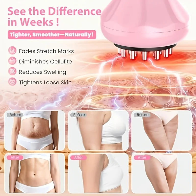 9-Level Electric Gua Sha Massager – Vibration & Microcurrent Electric Body Massager Qst
