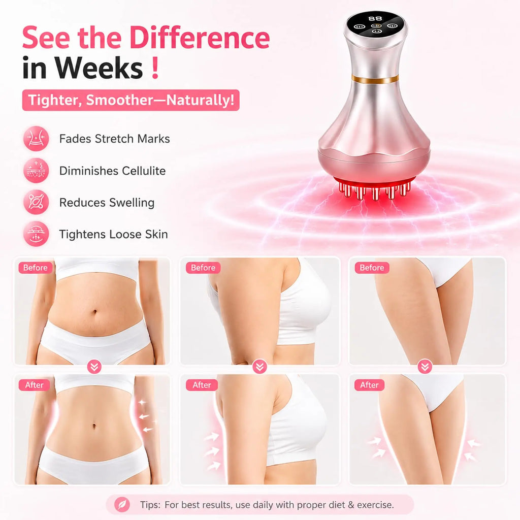 4-in-1 Electric Body Massager – Red Light, Heat & Microcurrent Electric Body Massager Qst