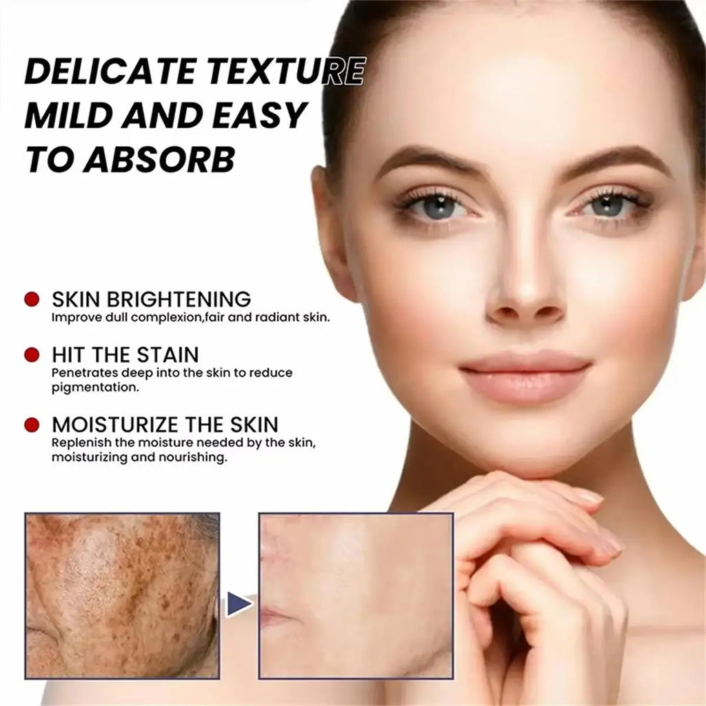 Brightening Dark Spot & Freckle Face Cream – Niacinamide Brightening Face Cream Qme