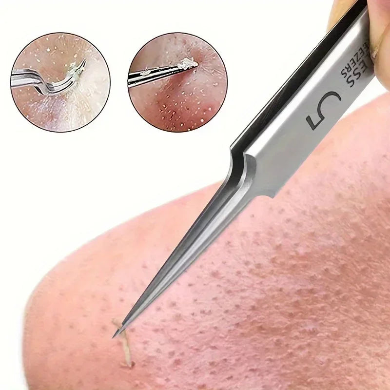 Extra Fine Blackhead Tweezers – Stainless Steel Facial Tool | Qme Facial Tweezers Qme