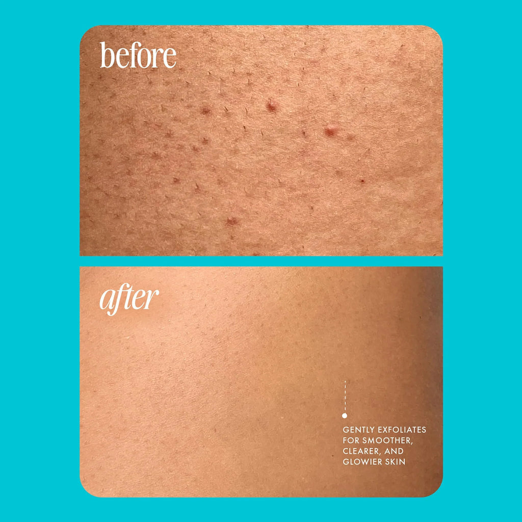 GZE Pre-Shave Exfoliating Body Scrub – Bikini Area Pre-Shave Body Scrub Qme