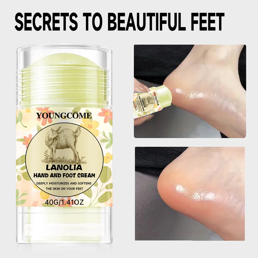 YOUNGCOME Foot Balm Stick – Hydrating Heel & Foot Cream 40g Foot Balm Stick Qst