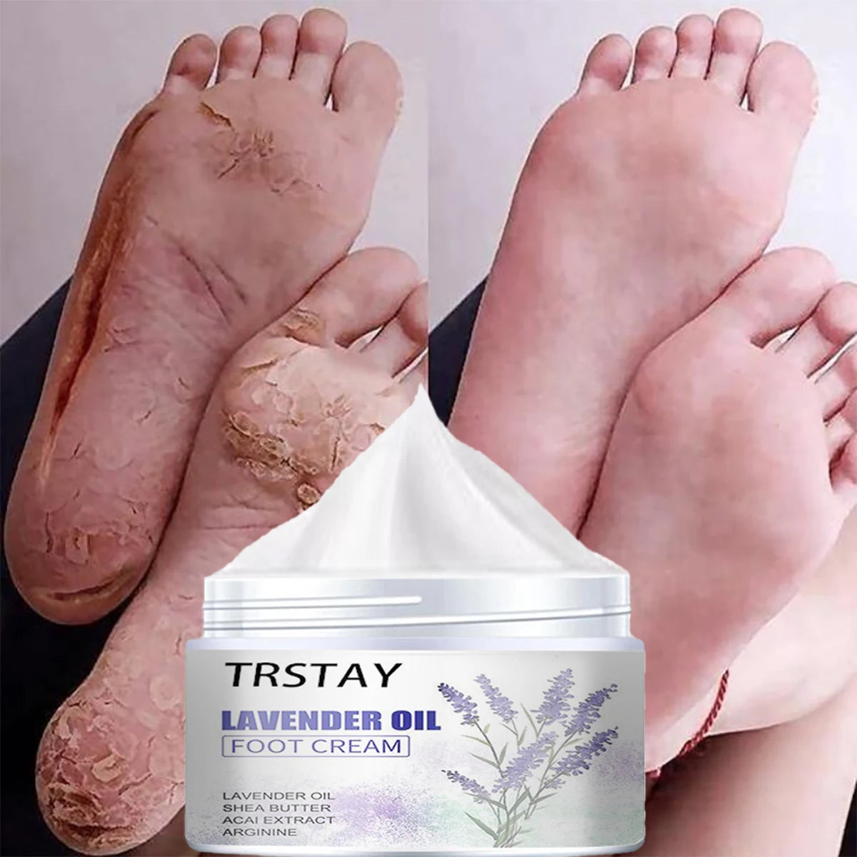 TRSTAY Lavender Foot & Hand Cream – Heel & Skin Care Foot & Hand Cream Qst