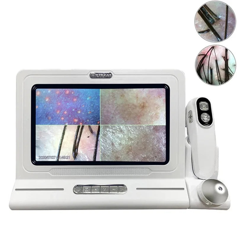 Vilnason 11" Scalp & Skin Analyzer | 50X 200X Dual Lens | 4 Spectrums Scalp Skin Analyzer Qst