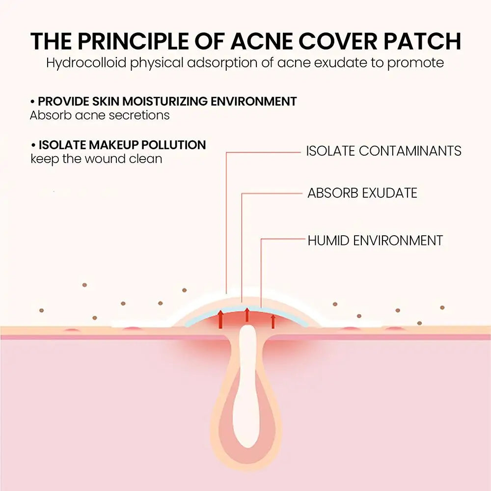 200-Count Star Shaped Hydrocolloid Pimple Patches – Colorful Pimple Patch Qme