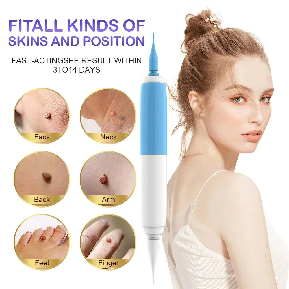 2-in-1 Skin Tag Removal Kit – Band Device for Face & Body Skin Tag Removal Kit Qst