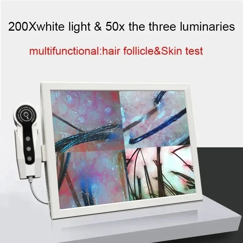 Vilnason 15" HD Scalp & Hair Analyzer 50x/200x Lens | BD-152A Scalp Hair Analyzer Qst