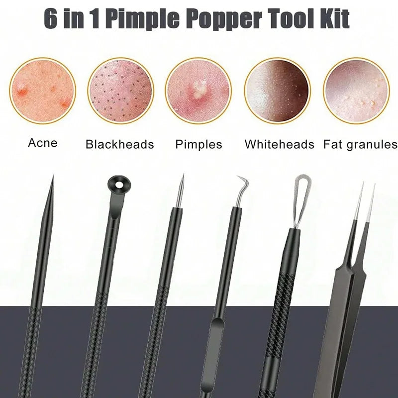 6-Piece Blackhead Remover & Blemish Extractor Tool Kit Skin Extractor Tool Qme
