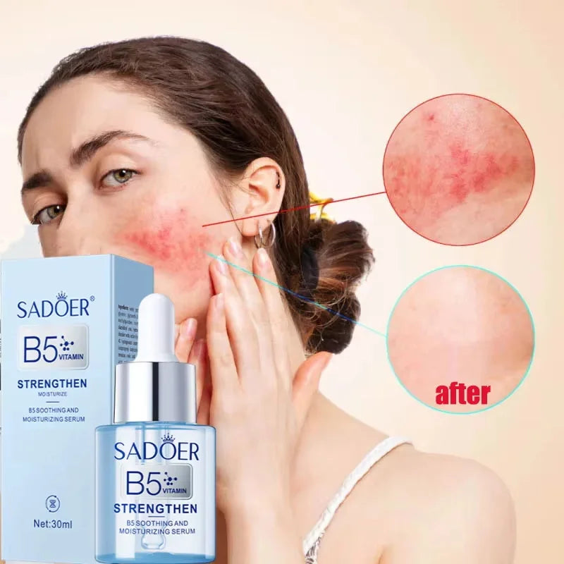 Facial Redness Repair Serum – Sensitive & Dry Skin Serum Facial Serum Qme