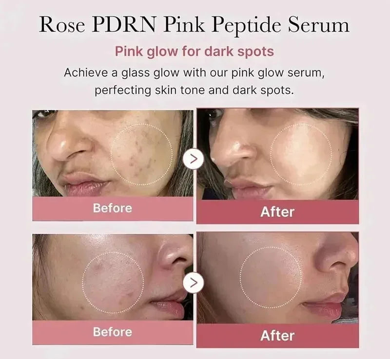 Niacinamide Dark Spot Correcting Face Serum | Brightening Brightening Face Serum Qme