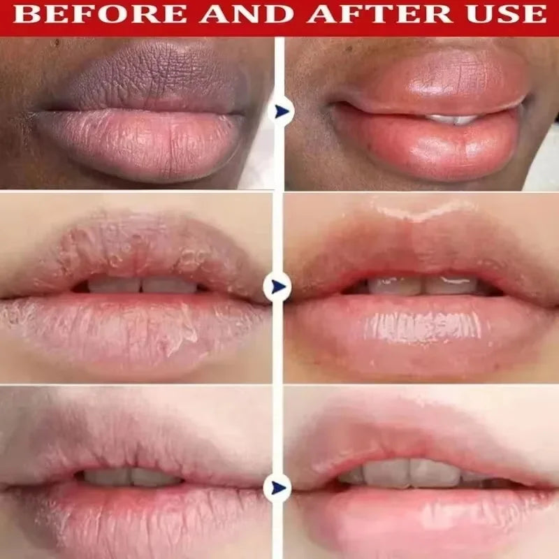 Brightening Lip Mask Balm & Serum – Exfoliating Lip Care Lip Mask Balm Qme