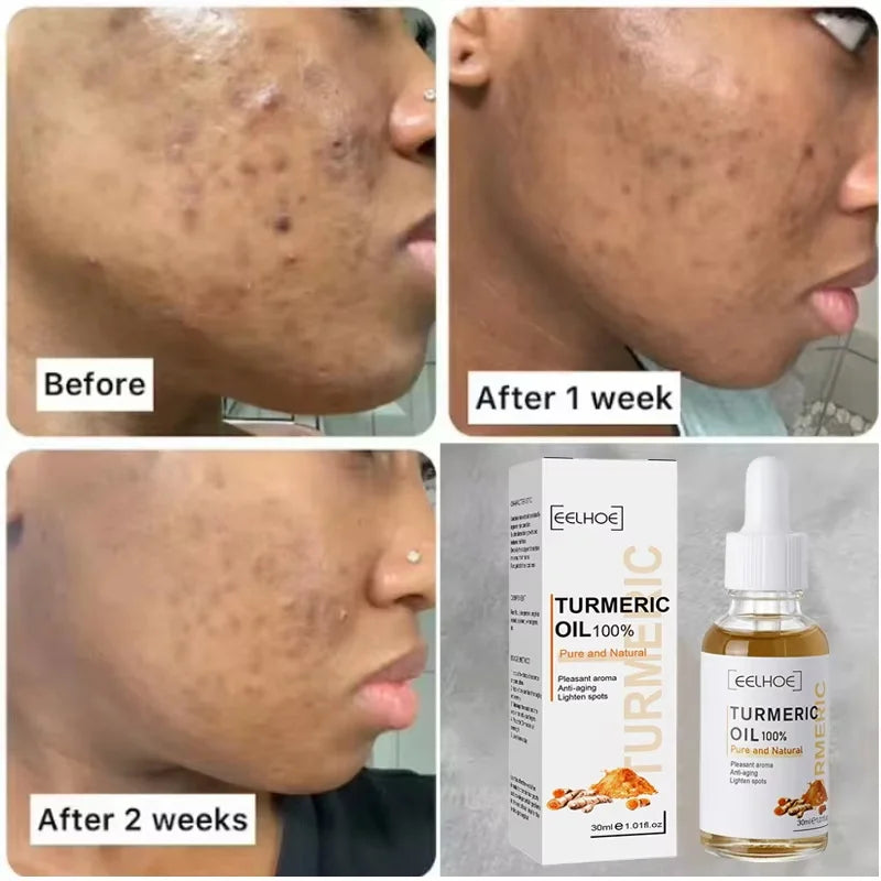 Turmeric Repair Essence – Brightens Dark Spots & Moisturizes Brightening Face Serum Qme