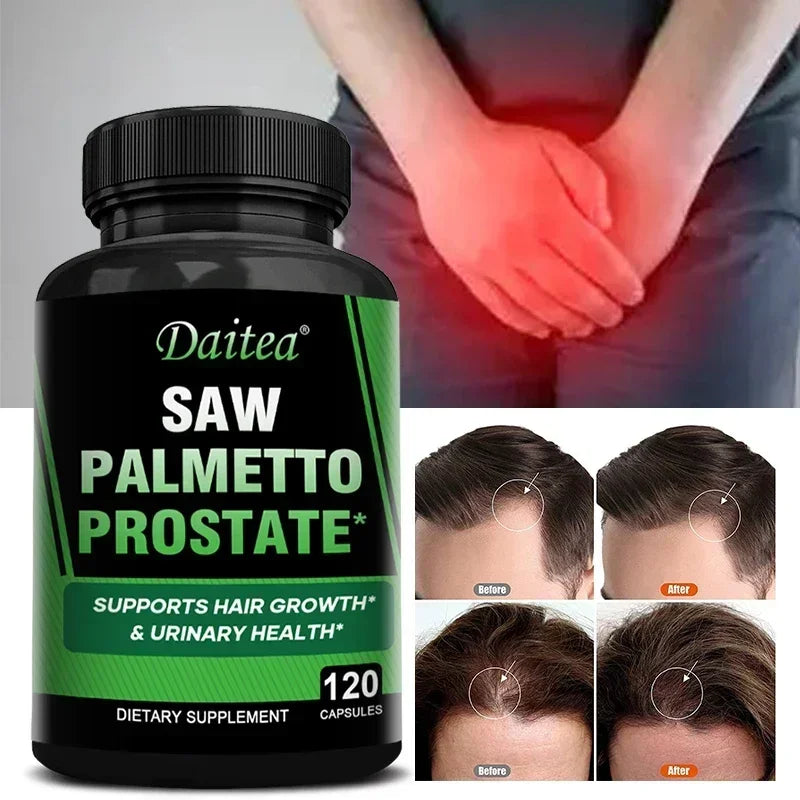 Saw Palmetto Capsules – Prostate & Hair Support Supplement Herbal Supplement Qst