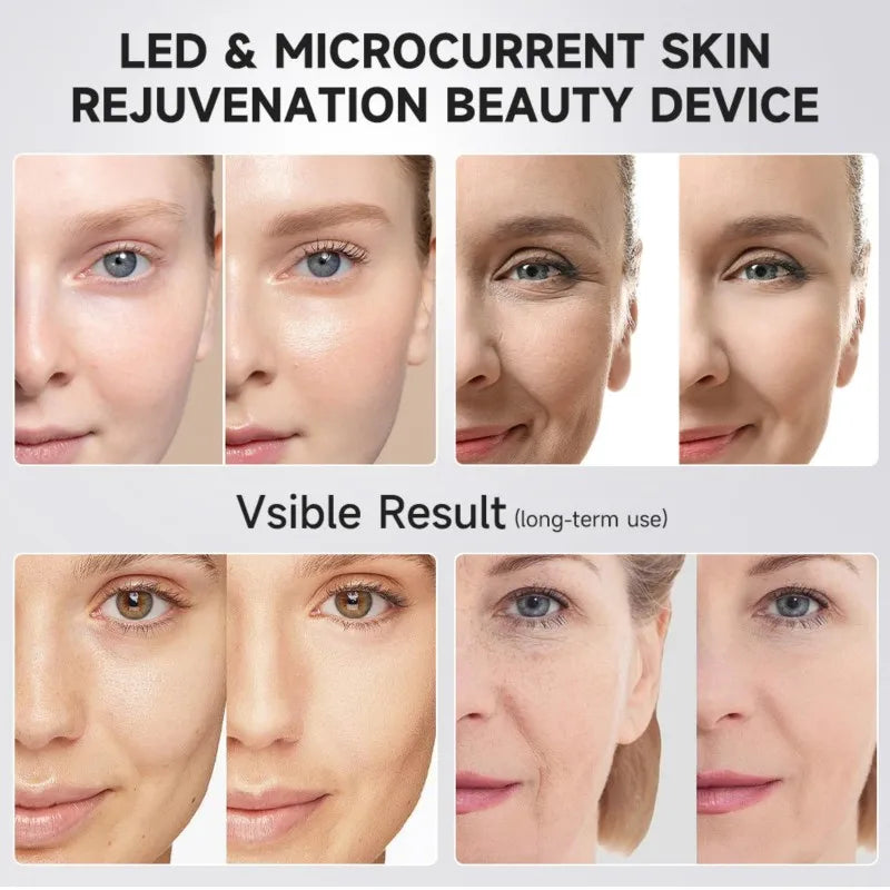 B15C 6-in-1 LED Beauty Device – EMS, Glow & Pore Care LED Skin Care Device Qst