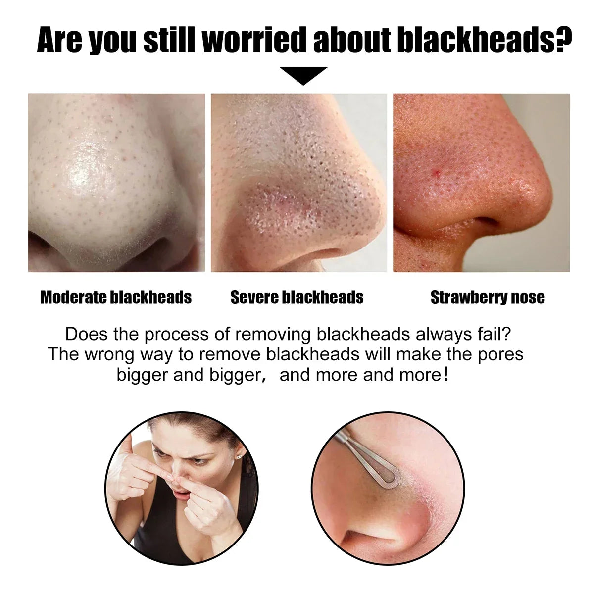 Qme Blackhead Remover Nose Patches – Gentle Deep Clean Nose Cleansing Patches Qme
