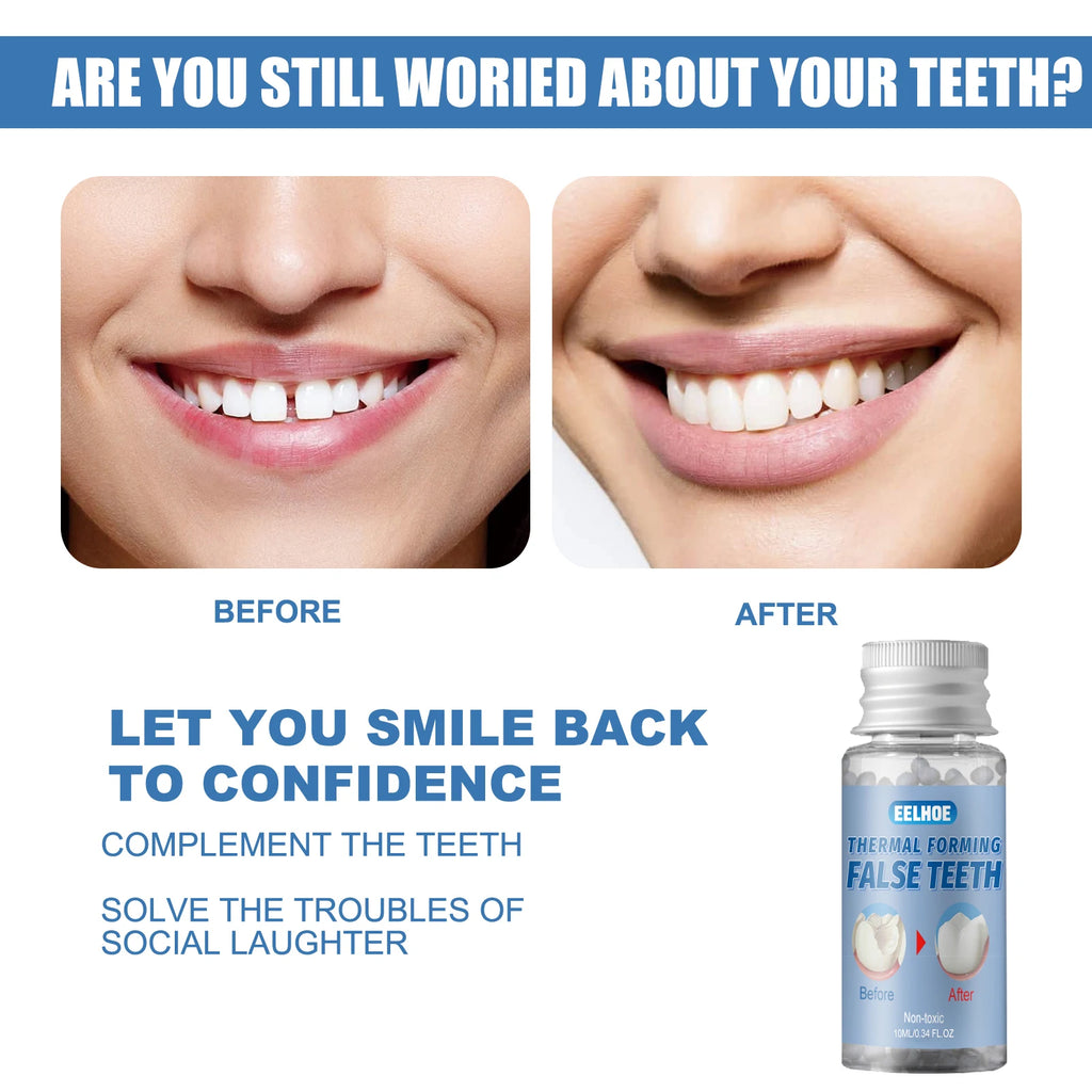 Moldable Temporary Teeth Gel – Cosmetic Tooth Filler Kit Temporary Tooth Filler Qst