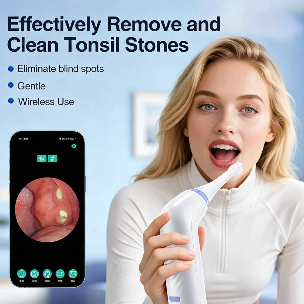Ms.Dear Electric Tonsil Stone Remover – HD Camera, 3 Suction Levels Oral Care Device Qst