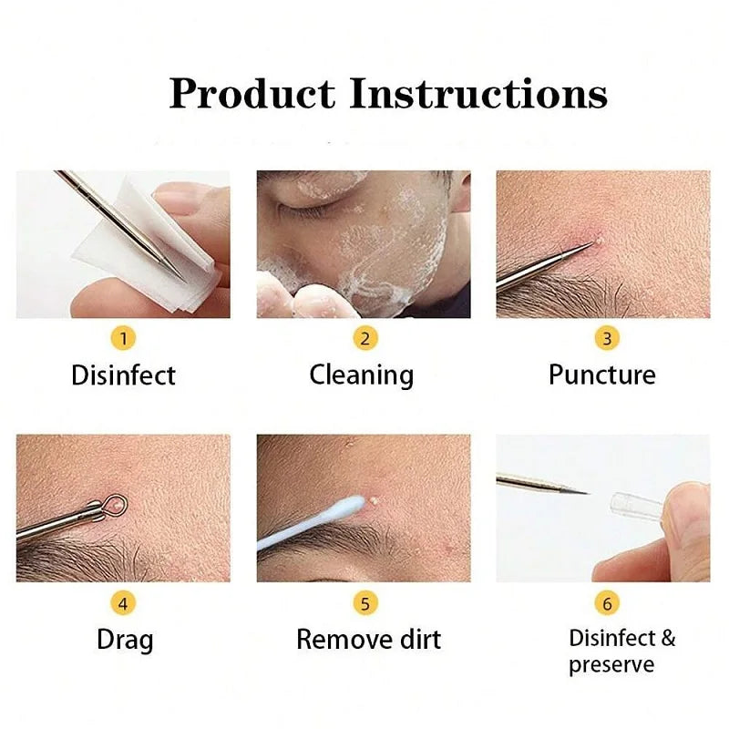 6-Piece Blackhead Remover & Blemish Extractor Tool Kit Skin Extractor Tool Qme