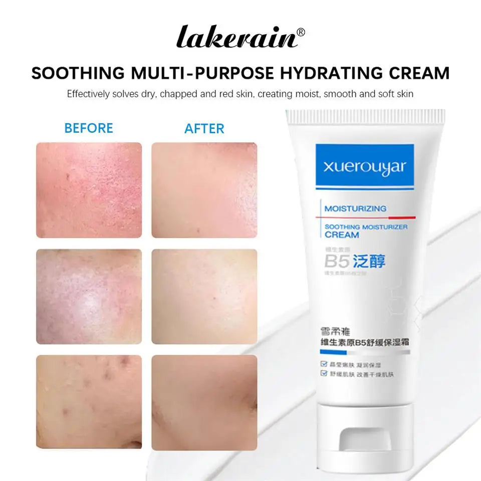 B5 Facial Redness Balancing Cream for Sensitive Skin | Qme Facial Redness Cream Qme