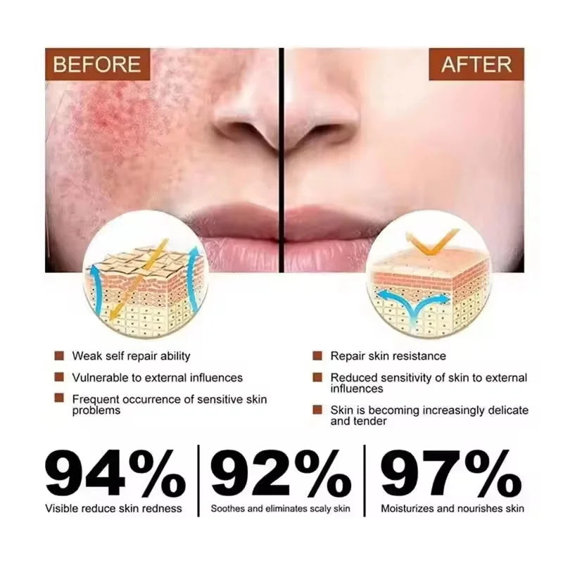 Facial Redness Repair Serum – B5 & Centella for Sensitive Skin Facial Repair Serum Qme
