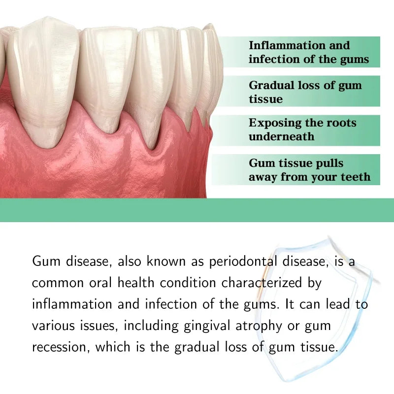 Gum Repair Care Gel – Deep Cleaning Toothpaste Serum Oral Care Gel Qme