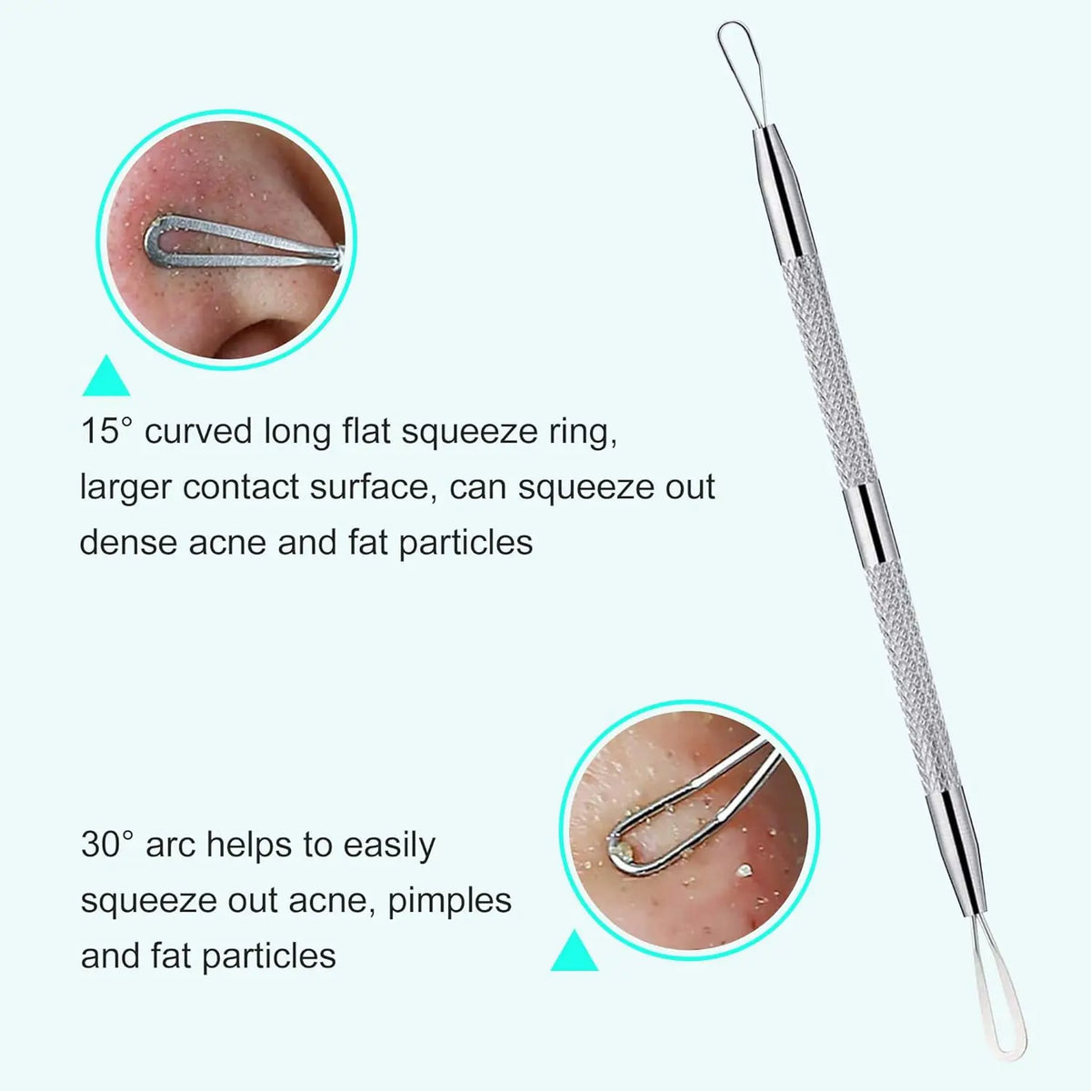 5-Piece Stainless Steel Blackhead Extractor & Blemish Tool Kit Blackhead Extractor Kit Qst