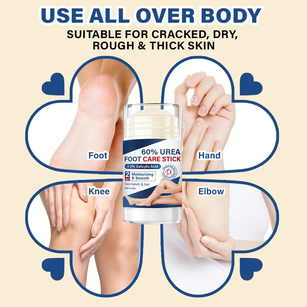 60% Urea Foot Care Stick – Shea Butter & Vitamin E Balm Foot Care Balm Stick Qst