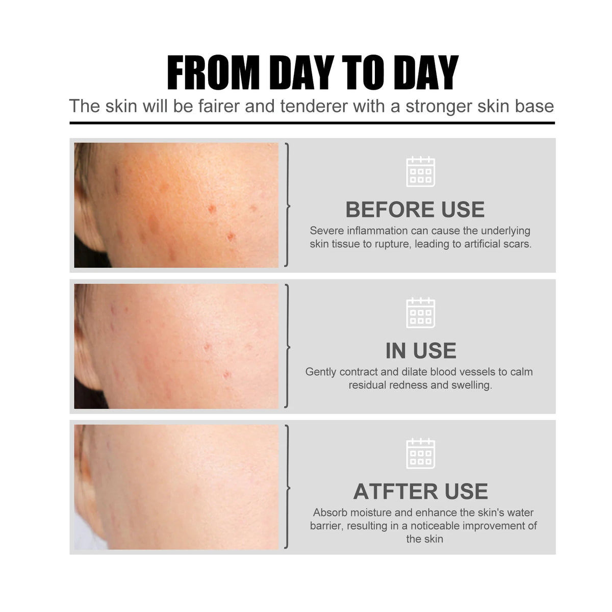 Eelhoe Niacinamide Facial Serum – Brighten, Hydrate & Firm Facial Serum Qst