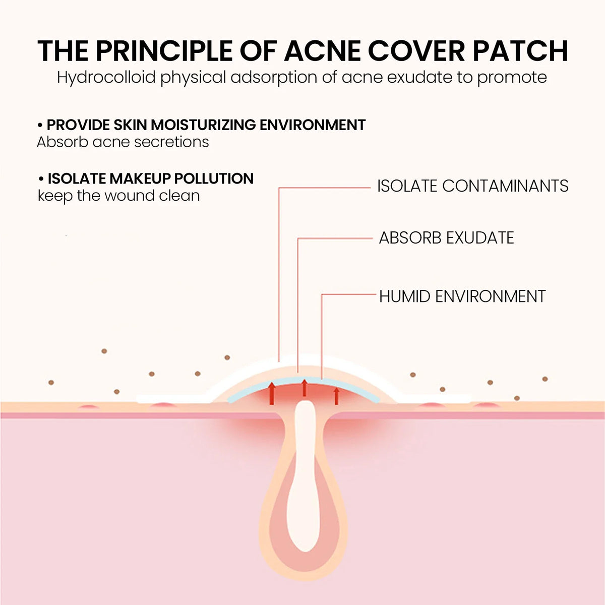 Hydrocolloid Acne Patches 200pc – Blemish Fading Star Shaped Acne Patch Qme
