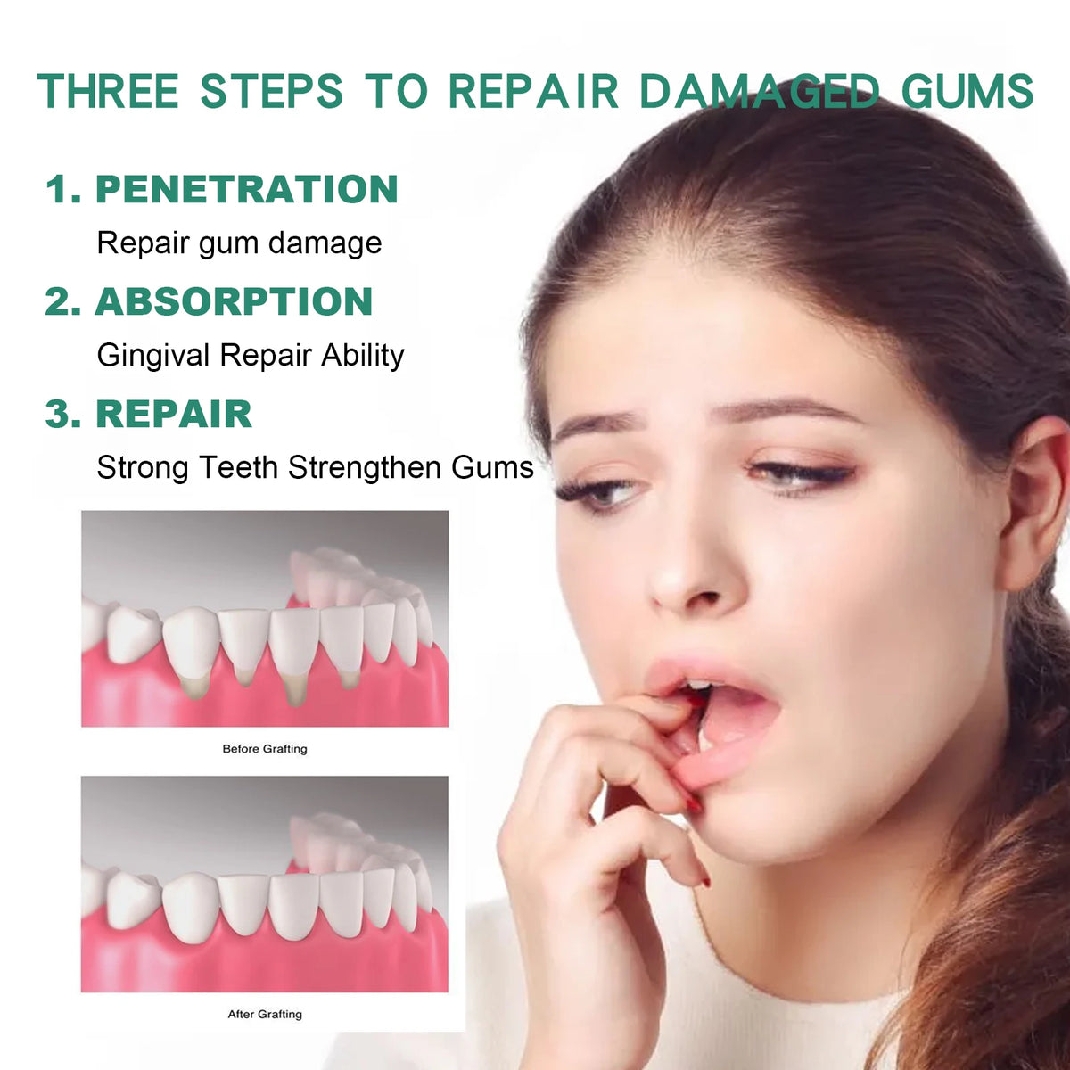 South Moon 30ml Gum Repair Drops – Oral Care & Whitening Oral Care Drops Qst