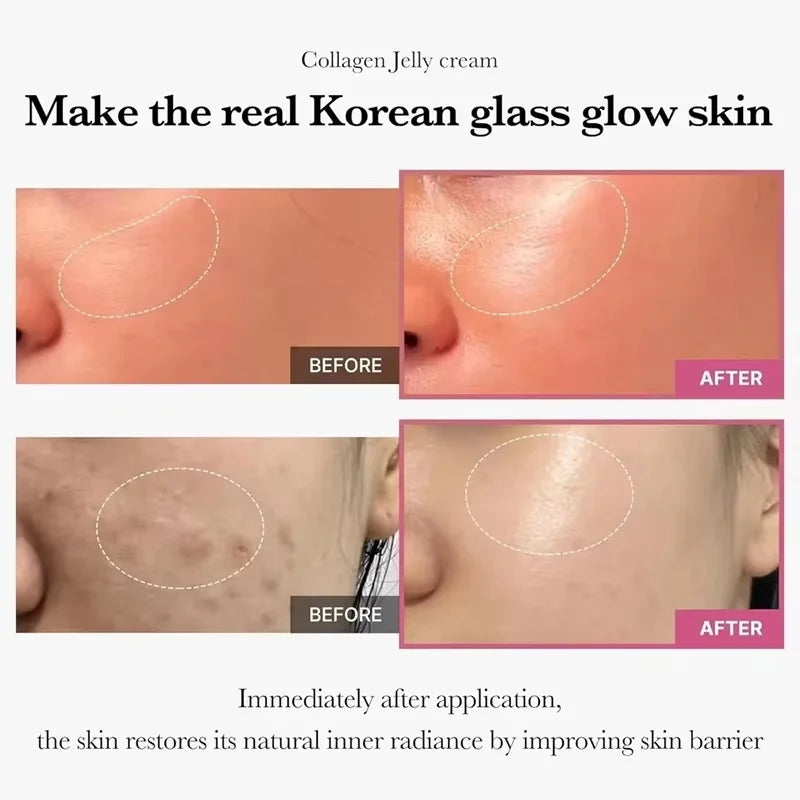 Collagen Jelly Face Cream – Nourishing SPA Moisturizer Face Moisturizer Qme