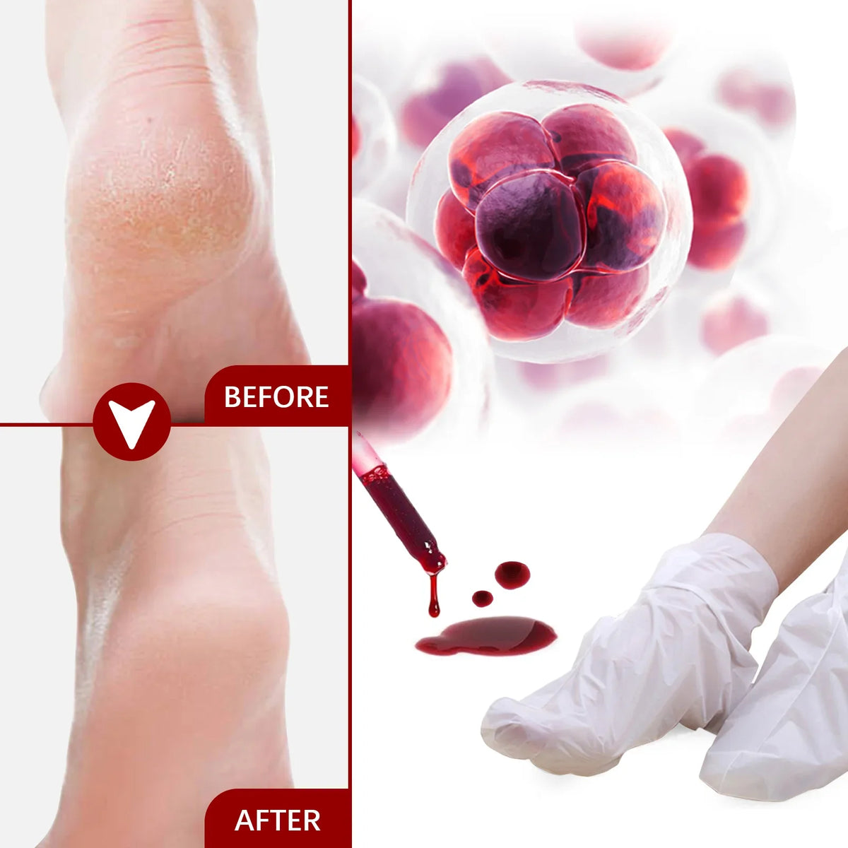 AHA Exfoliating Foot Mask – Moisturizing Heel & Callus Peel Exfoliating Foot Mask Qme