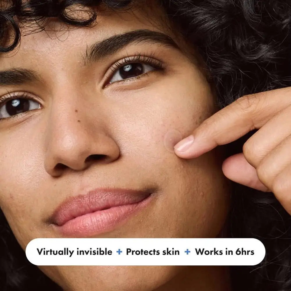 400 Invisible Hydrocolloid Acne Patches – Spot Stickers Acne Spot Patches Qme