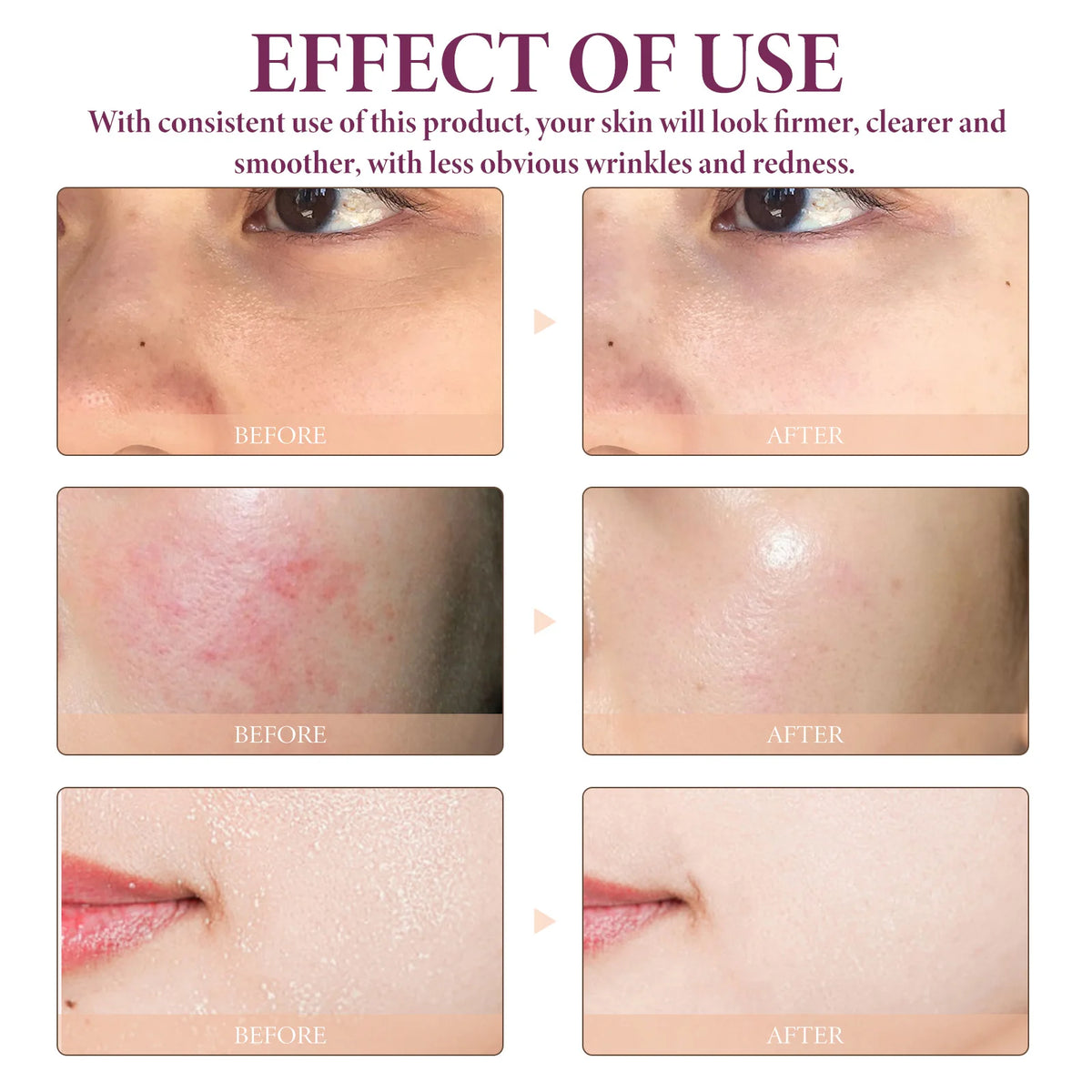 OceAura Glycolic & Lactic Acid Face Serum – Pore Refining 50ml Face Serum Qst