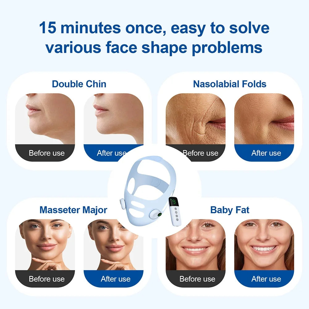 V Line Face Lifting Strap & Chin Slimming Massager Mask Face Lifting Mask Qst