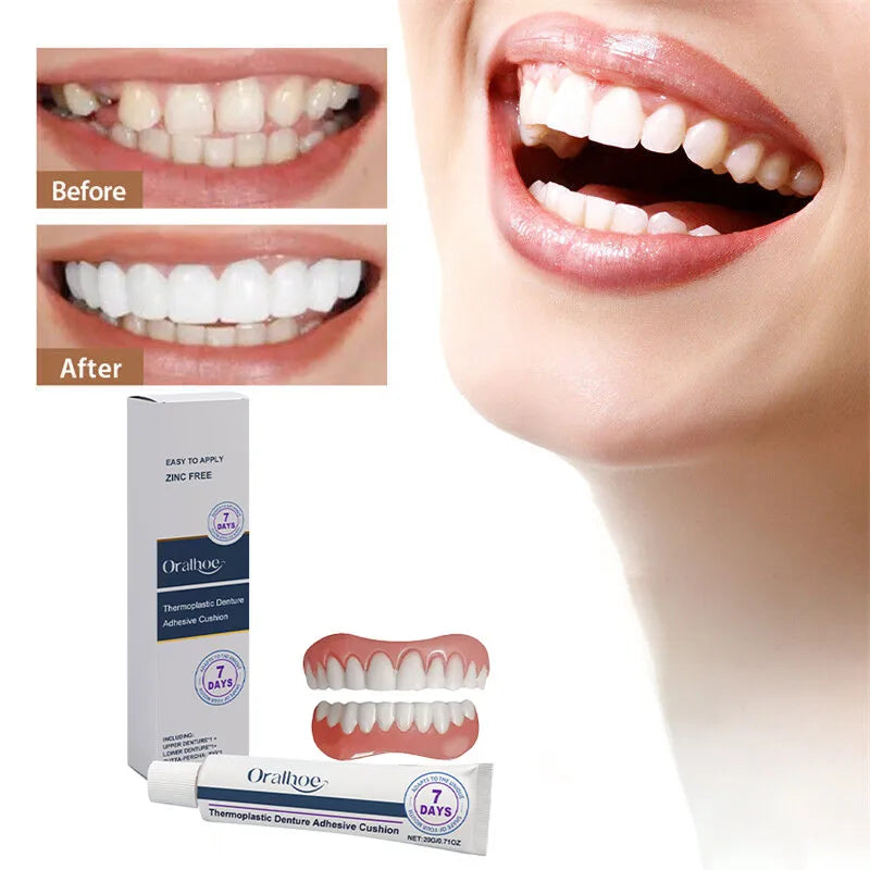 Silicone Denture Reliner Kit – Temporary Adhesive Brace Set Denture Reliner Kit Qst
