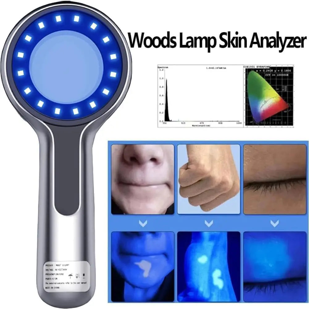 Wood's Lamp Skin Analyzer – 365nm UV, 16 LED, 4000mAh UV Skin Analyzer Qst