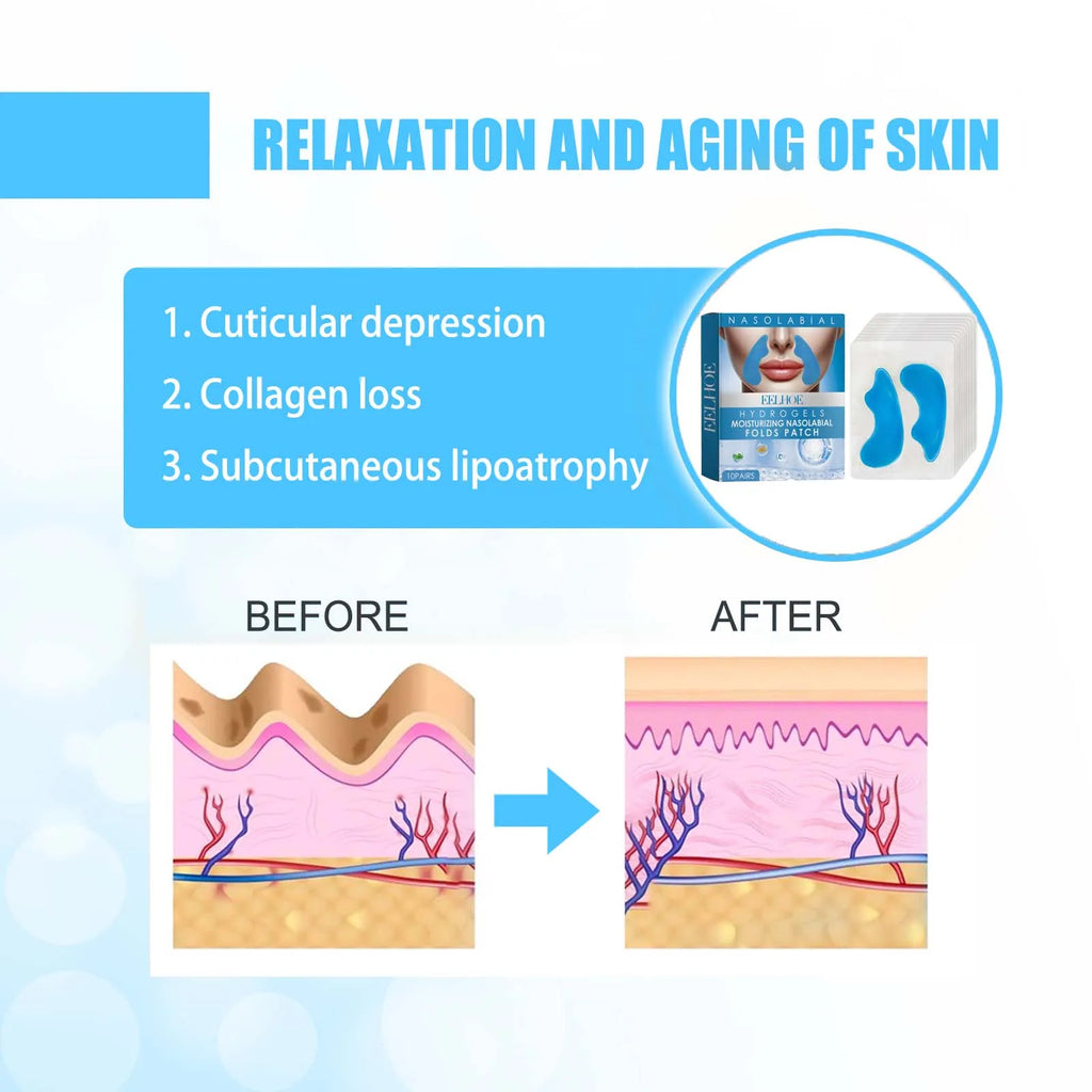 Nasolabial Fold Gel Patches – Hydrating, Firming & Smoothing Facial Gel Patch Qme