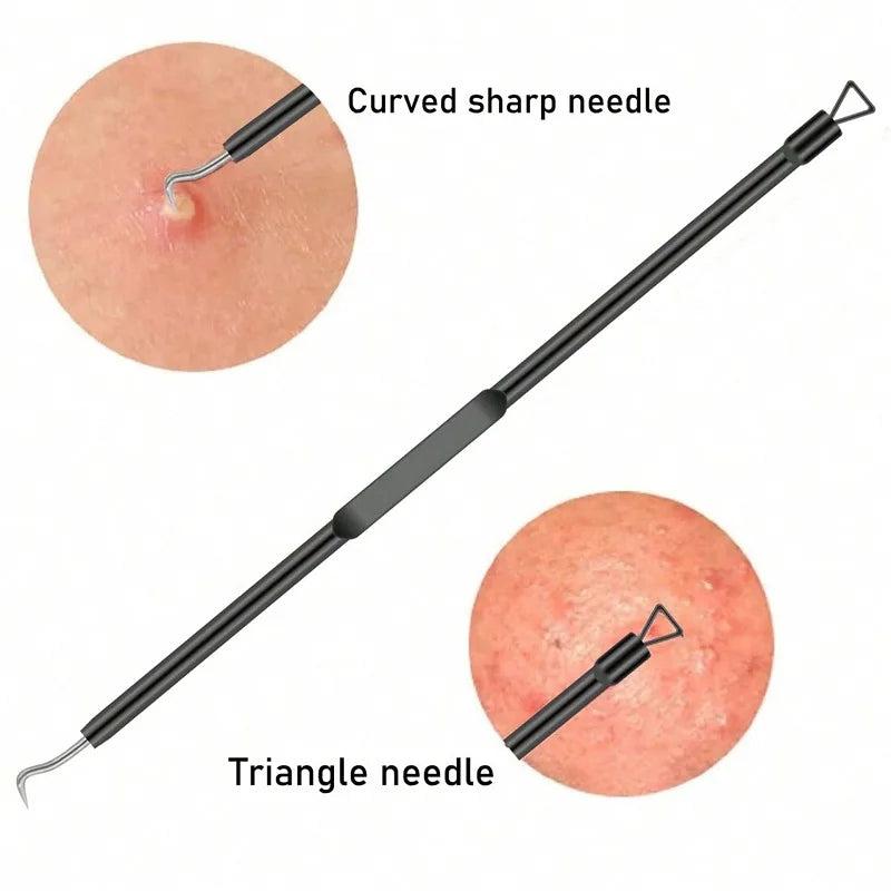 6-Piece Blackhead Remover & Blemish Extractor Tool Kit Skin Extractor Tool Qme