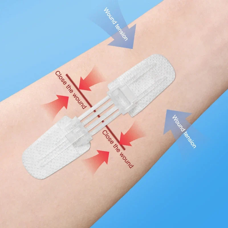 Zipper Wound Closure Patch – Sutureless Waterproof Bandage Wound Closure Patch Qme