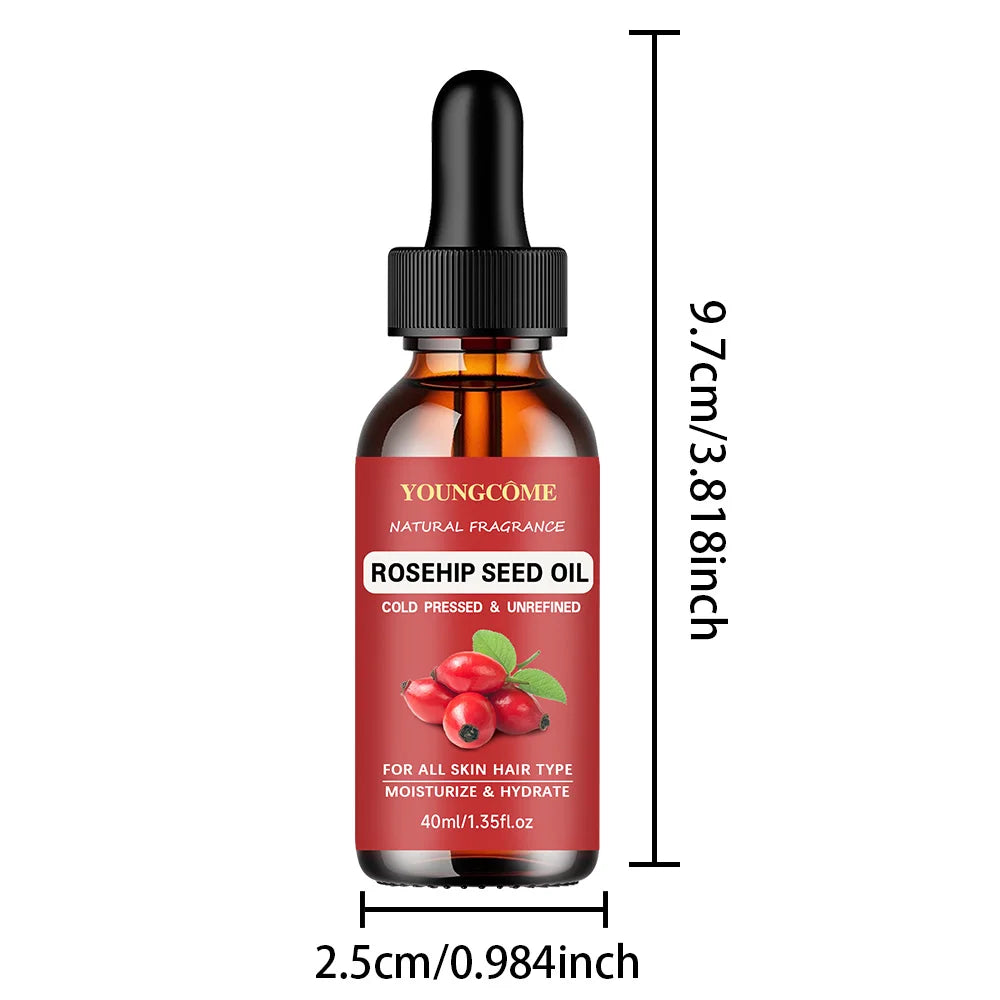 YOUNGCOME Rose Essential Oil – Aromatherapy & Skin Care 40/60ml Essential Oil Qst 40ml Other