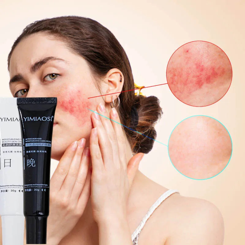 Facial Redness Repair Cream – Sensitive Skin Moisturizer Facial Moisturizer Cream Qme