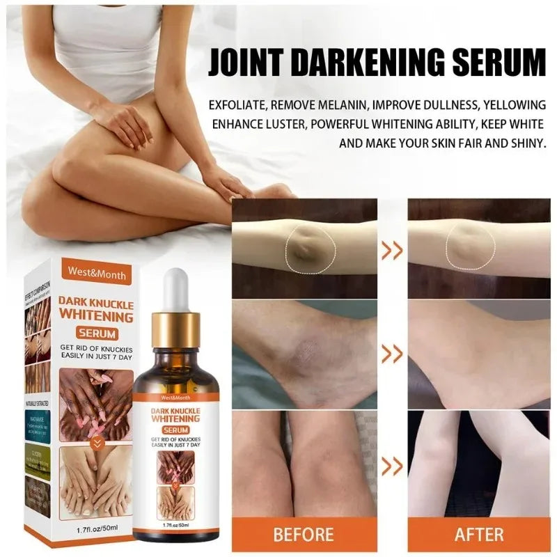 Skin Brightening Essence – Knuckle, Elbow & Knee Serum 50ml Brightening Body Serum Qst