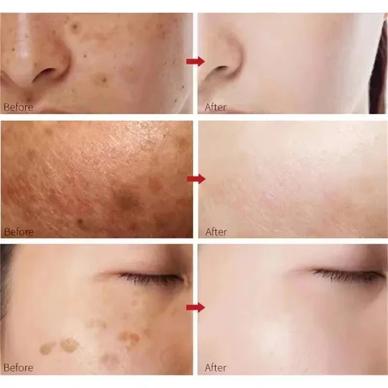 Turmeric Brightening Essence – Dark Spot & Pigmentation Serum Brightening Face Serum Qme