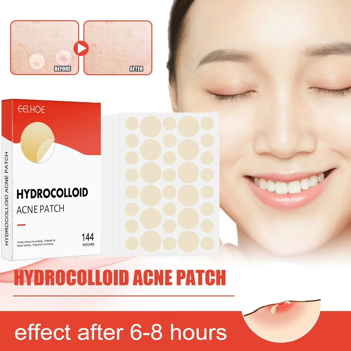Hydrocolloid Acne Patches – 2 Sizes, Invisible & Makeup-Friendly Acne Patches Qme