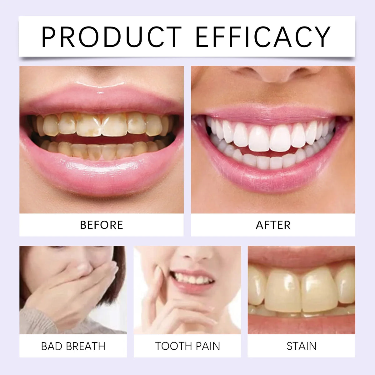 Purple Teeth Brightening Strips – Color-Correcting Dental Patches Teeth Brightening Strips Qst