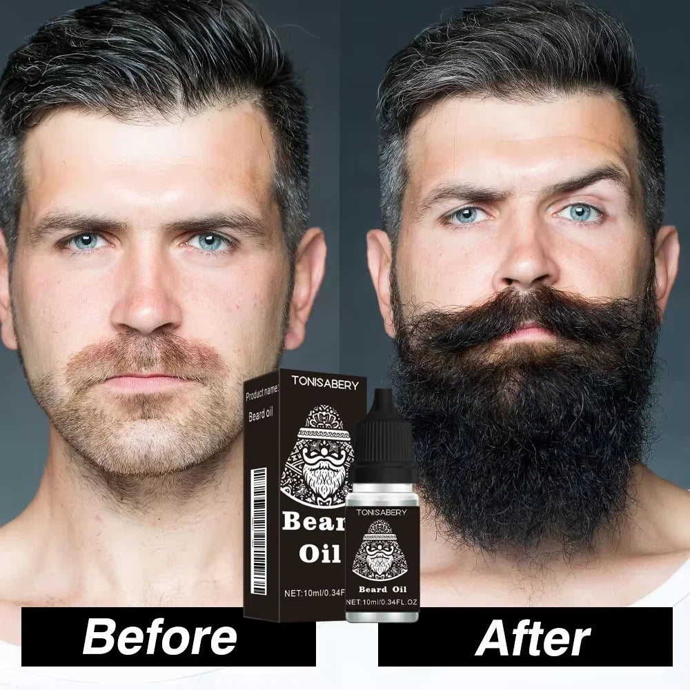 Beard Growth Serum for Men – Thicker, Fuller, Stronger Beard Beard Growth Serum Qme