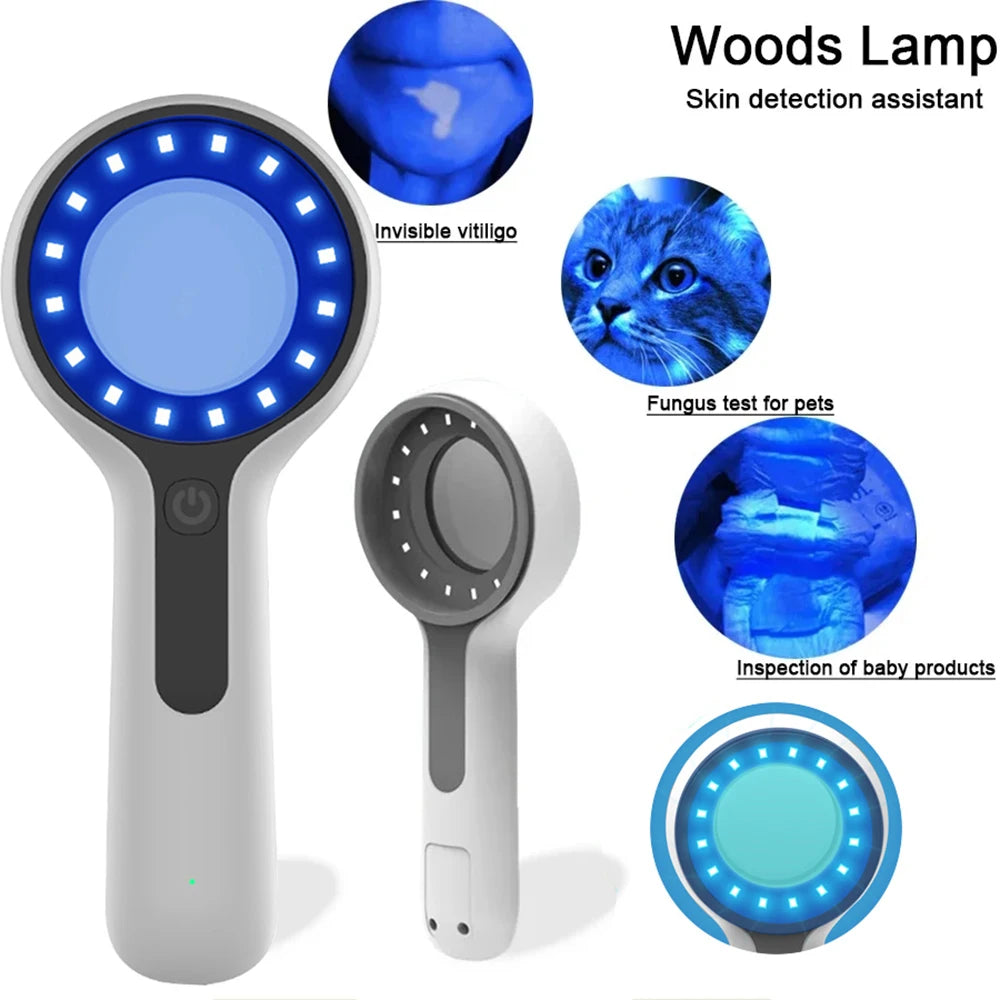 Wood Lamp Skin Analyzer – UV Magnifying Facial Skin Tester Skin Analyzer Lamp Qst