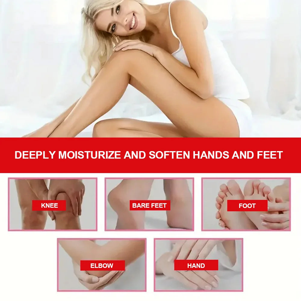 YOUNGCOME 42% Urea Strawberry Hand & Foot Cream 30g/60g Hand & Foot Cream Qst